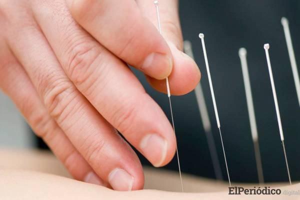 homeopatía-acupuntura Aseguradoras españolas