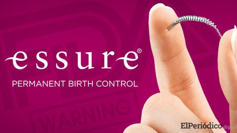 ESSURE Cropped