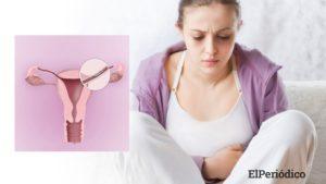 Australia: Bayer es denunciado por los nocivos efectos que causó el anticonceptivo Essure 1 Essure