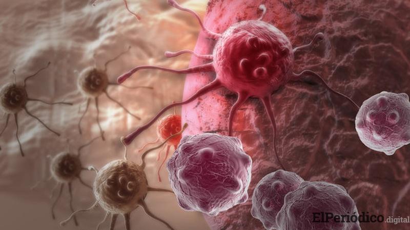 En España desarrollan una inmunoterapia apta para un tipo de cáncer de mama cáncer de mama