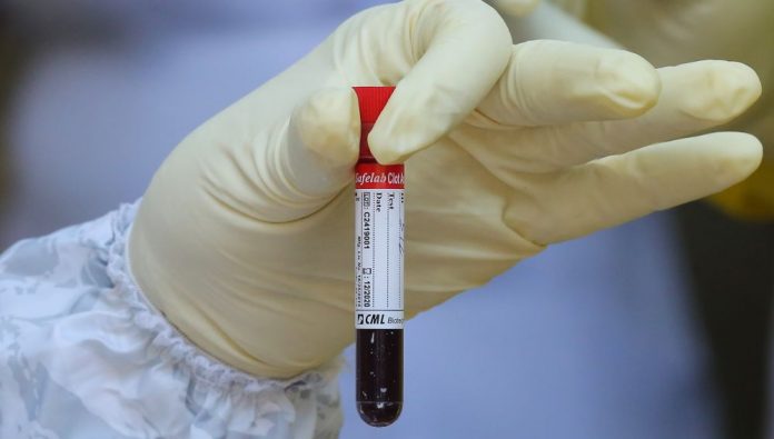 ESTUDIO REVELA LOS GRUPOS SANGUINIOS CON MAYOR PROTECCION FRENTE AL CORONAVIRUS