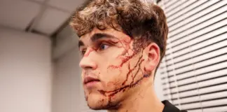 Ensangrentada, desfigurada y con seis puntos: así quedó la cara de Pau Cubarsí tras una patada en la mejilla