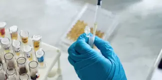 Dos nuevos tests de sangre para detectar el alzhéimer muestran resultados prometedores en un ensayo