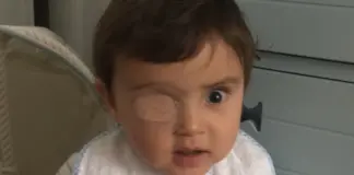 ¿Por qué a algunos niños pequeños se les tapa un ojo con un parche?