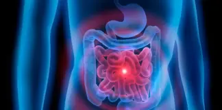 Detectan un "aumento importante" del cáncer colorrectal en menores de 50 años: motivo y síntomas