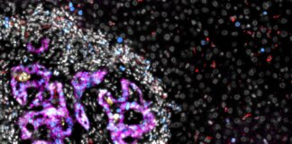 Investigadores españoles logran avances en el tratamiento contra el cáncer de hígado