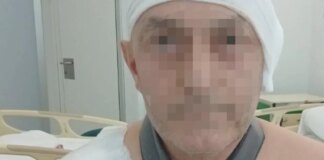 Varios jóvenes propinan una brutal paliza a un hombre cuando paseaba por El Malecón, en Murcia