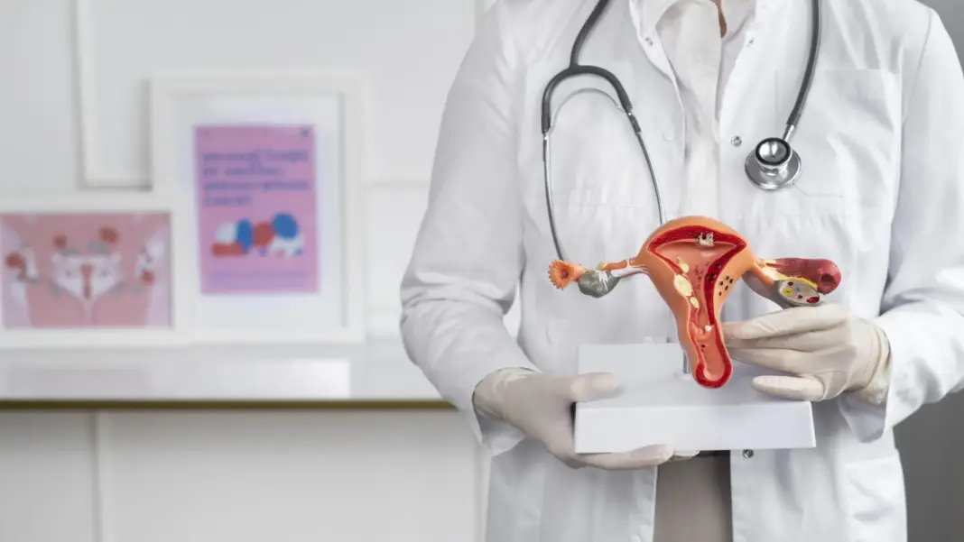 Así se manifiesta la cervicitis: síntomas de esta infección que triplica el riesgo de cáncer de cérvix