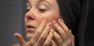 TikTok enloquece con este bálsamo perfecto para hidratar la piel seca en invierno